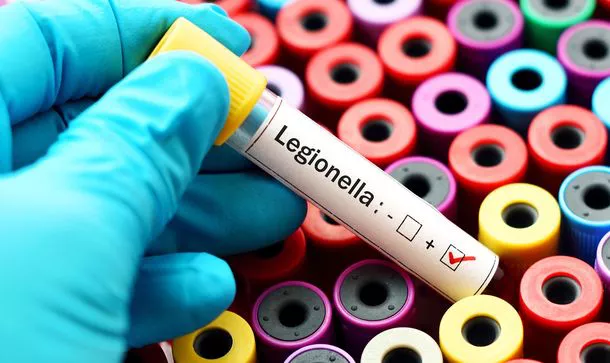legionellajpg