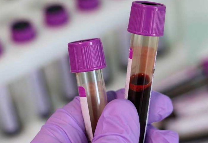 Coronavirus